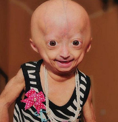 adalia rose childhood pic